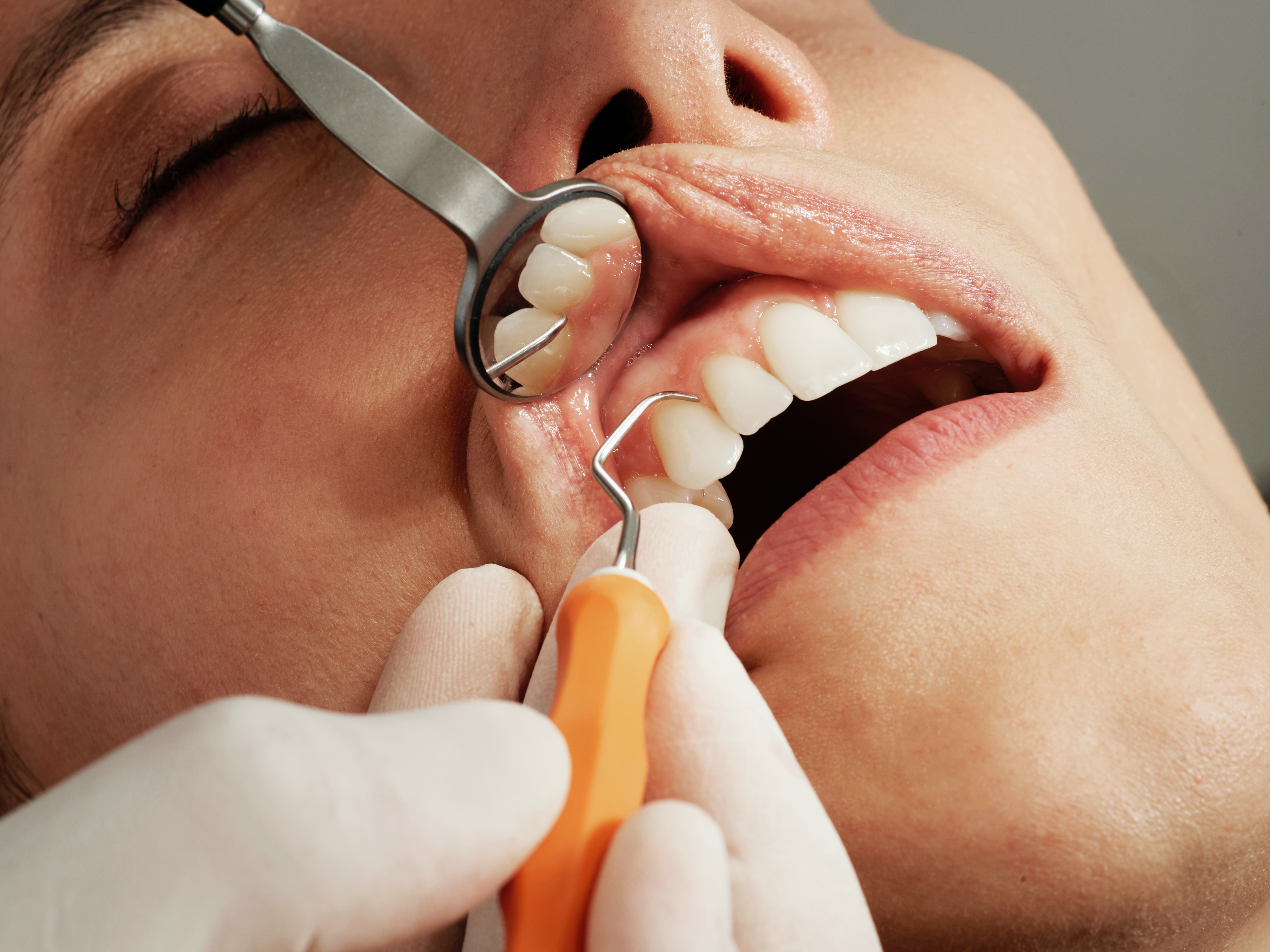 Dentist Advises Against Four Common Practices That Could Ruin Our Teeth