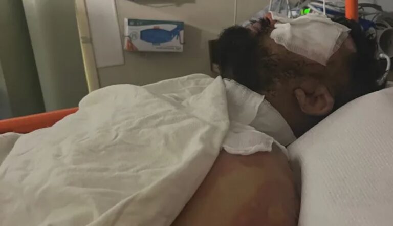 Watch Shoplifter sets San Francisco store clerk on fire, Sheriff’s office arrest suspect